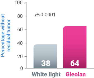 White_Light_Vs_Gleolan_Chart