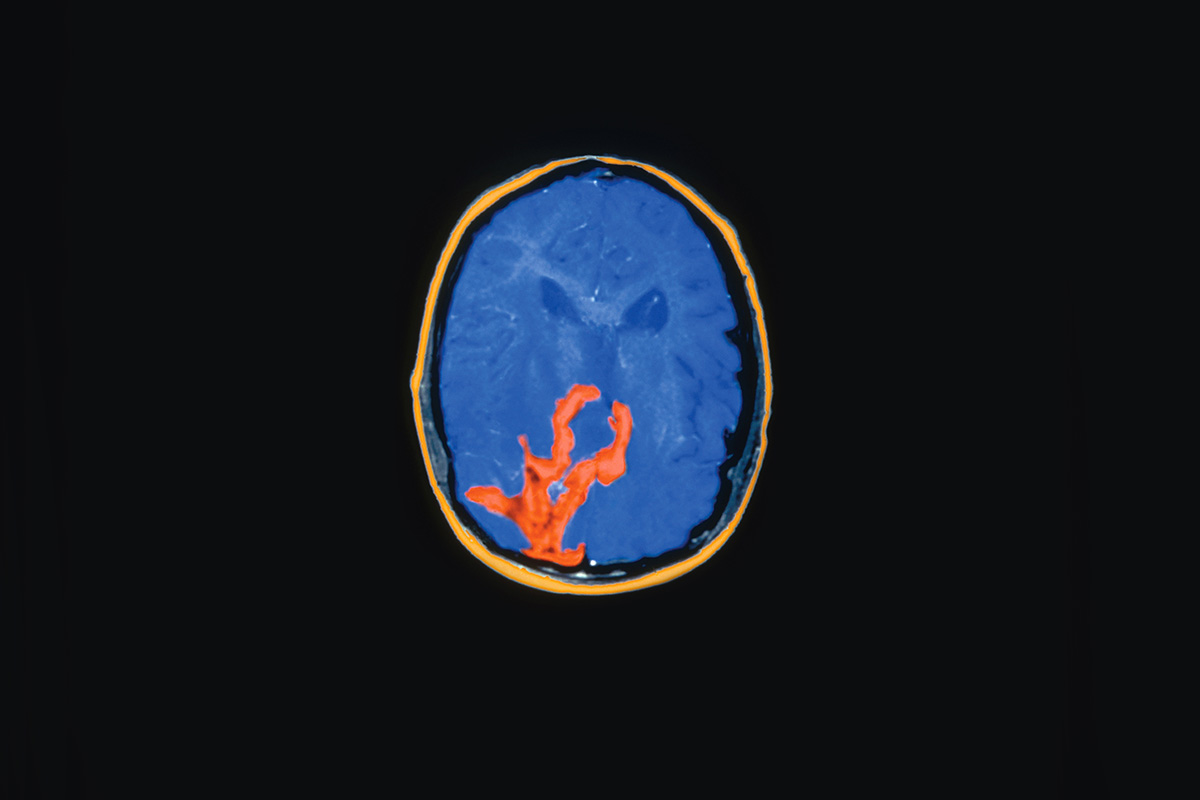 scan of inside of brain